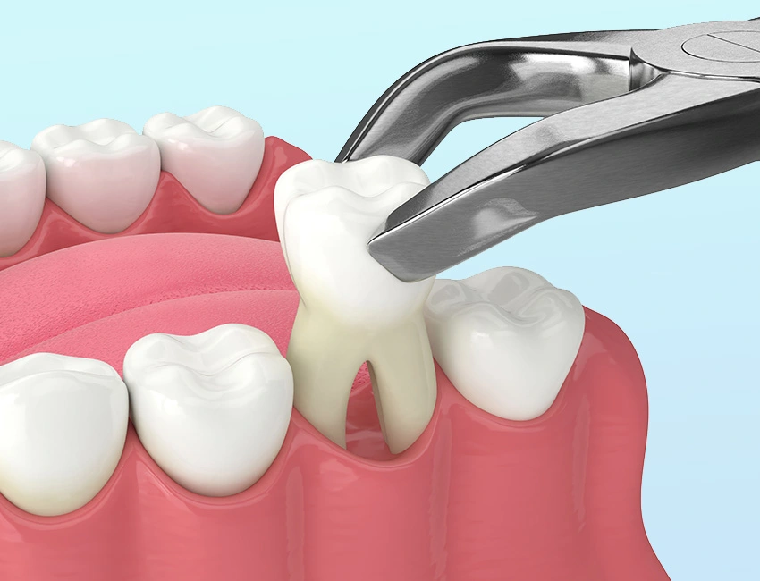 Best dental clinic in Bangalore