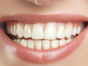 Bangalore’s Rising Trend in Cosmetic Dentistry